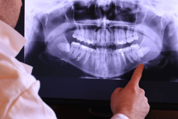 Best Broken Tooth Emergency  in Portsmouth, NH