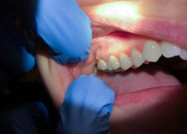 Best Cracked Tooth Emergency Dentist  in Portsmouth, NH